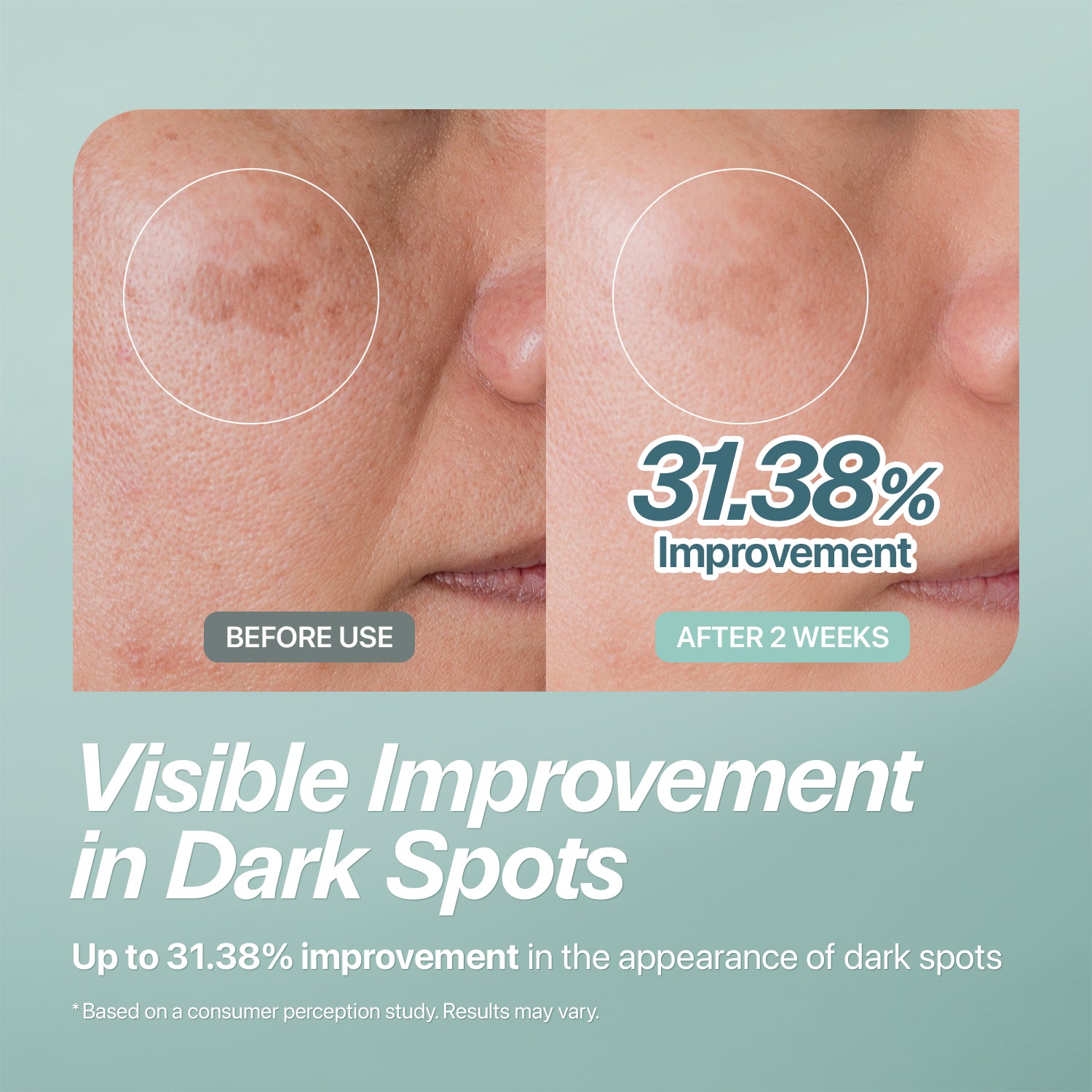 Mela Care Peel Cream Mask